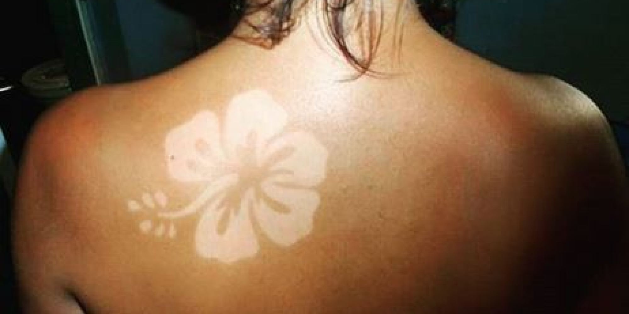 Tatuajes solares, una peligrosa forma de broncearse
