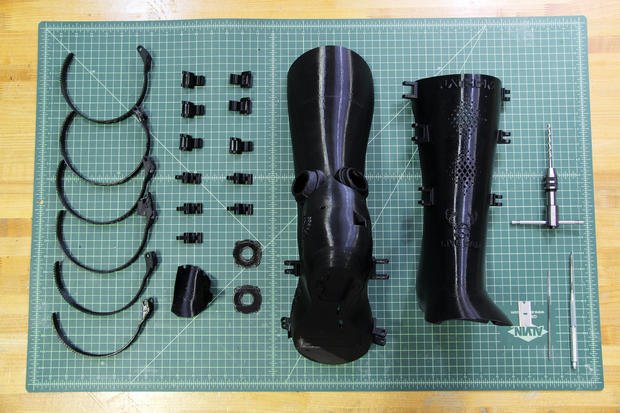 3D-printed BoomCast heals broken bones the connected way