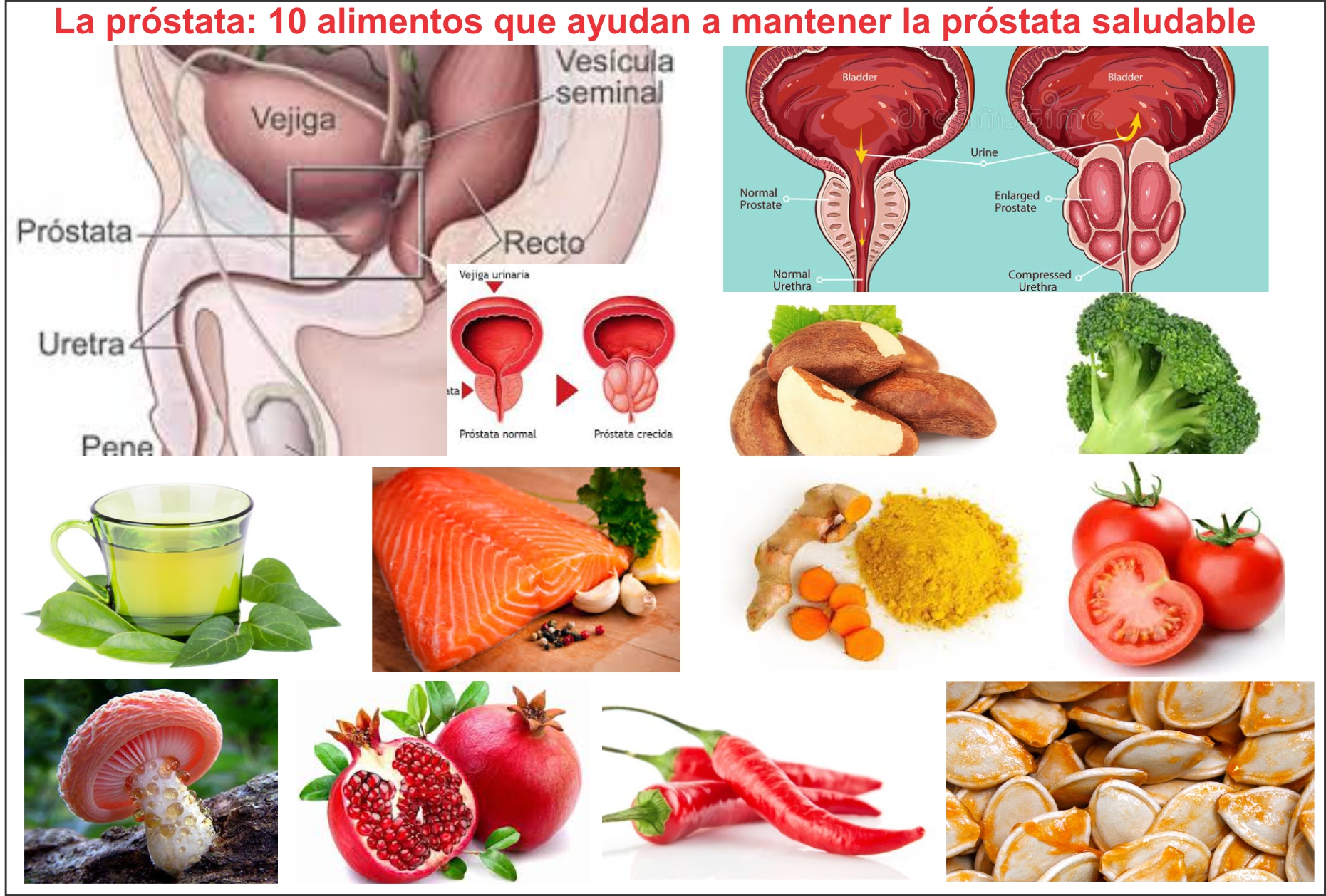  Alimentos para mantener tu próstata en buen estado. Síntomas de enfermedad 