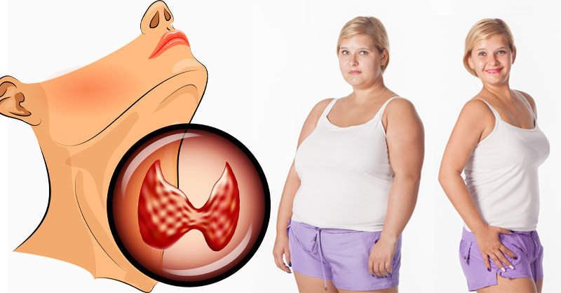 The best way to lose weight when you have hypothyroidism