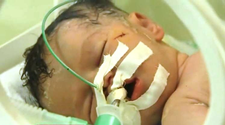 La bebé que nació de una madre muerta en Gaza 