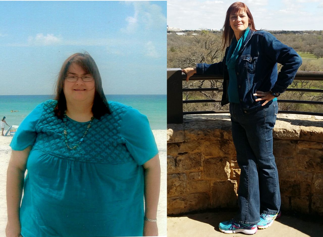 Woman's inspiring story of 243-pound weight loss