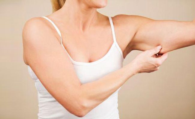 Las 5 mejores formas de adelgazar los brazos