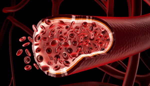 ¿Cómo limpiar los vasos sanguíneos de colesterol?