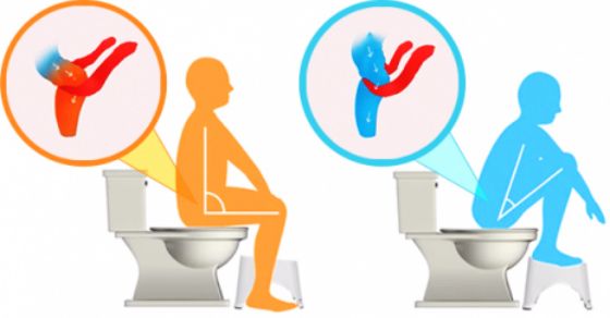 The right form to do poop: Squatty Potty position