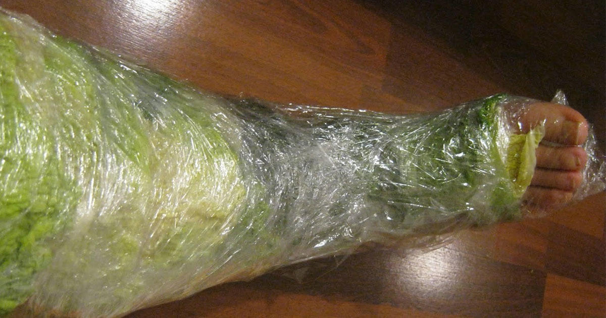  Wrap your leg in cabbage for 1 hour can help with joint pain