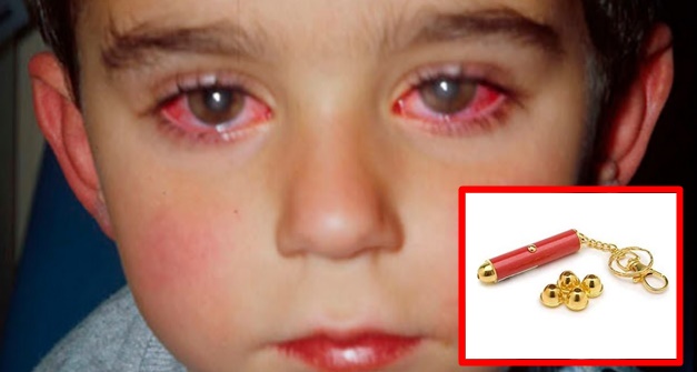 Este niño perdió el 75% de la vista por un juguete que probablemente tenga en casa