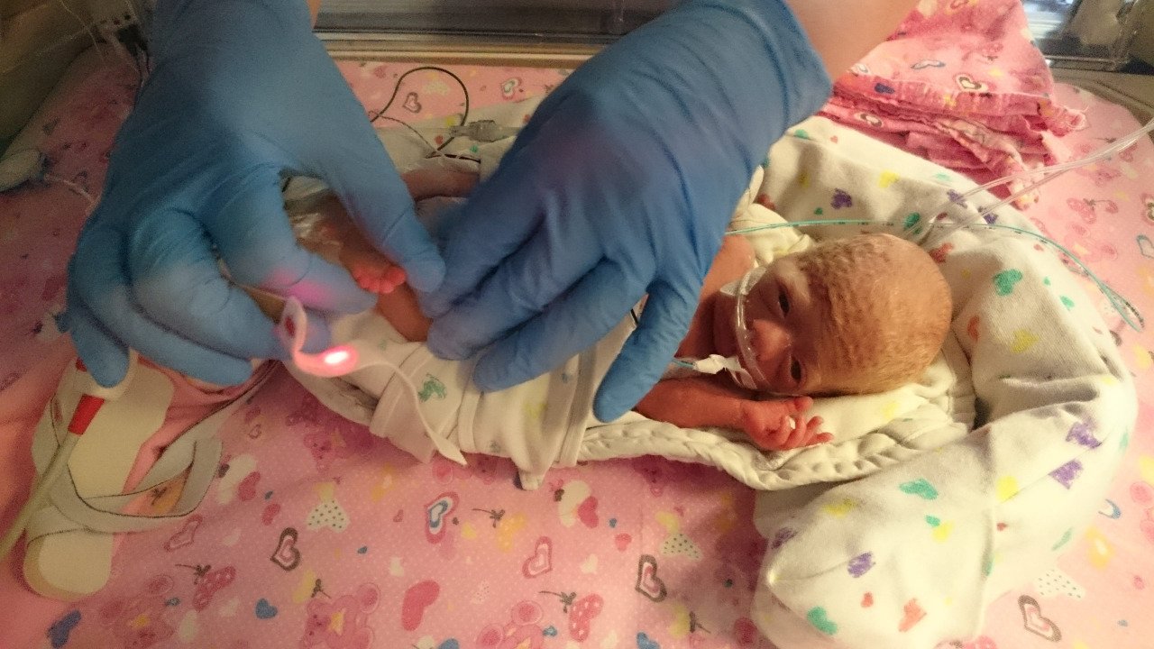 Baby Born Three Months Premature Kept Alive By Doctors Who Bundled Her