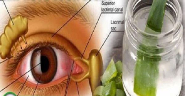 Mejora la presión y la visión intraocular con este remedio casero