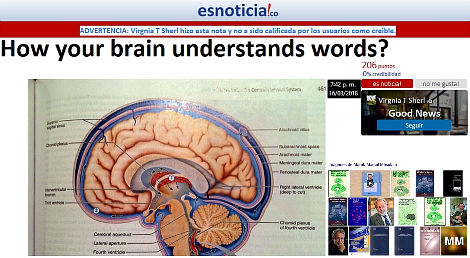 ¿Cómo entiende tu cerebro las palabras? (Traducción)