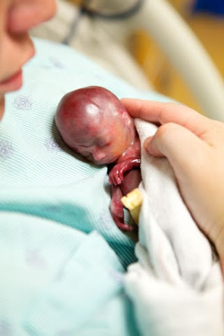 El bebé que está cambiando el debate sobre el aborto