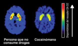 Cocaína: efectos a corto y largo plazo