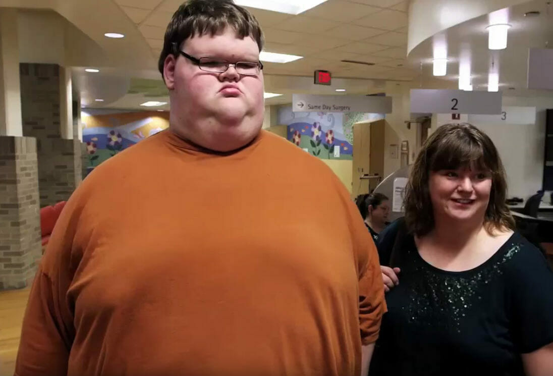 Con 325 kg era el adolescente más gordo del mundo, su apariencia ahora es impactante