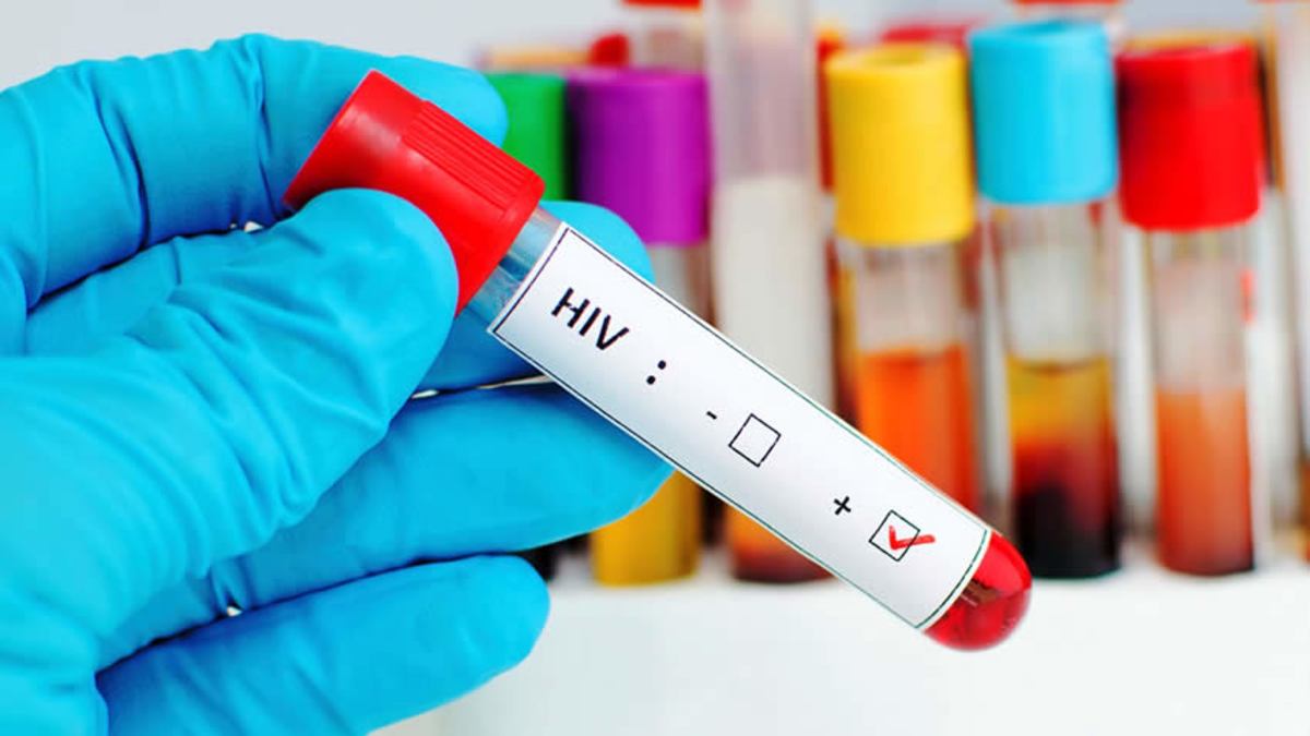 Científicos logran eliminar virus del VIH en seis pacientes