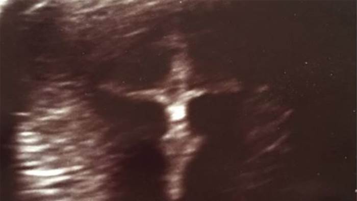 Ultrasound photo appears to show crucifix, reassures mom of baby's health