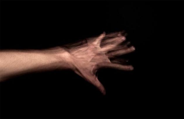 La historia de la mujer con síndrome del Dr. Strangelove que fue atacada por su propia mano