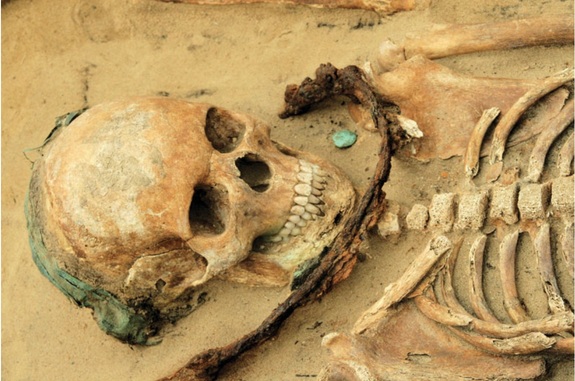 Sickle-Wearing Skeletons Reveal Ancient Fear of Demons