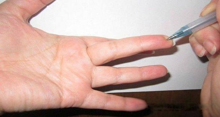 Un punto particular en el dedo: Alivia de inmediato la presión y elimina cualquier dolor