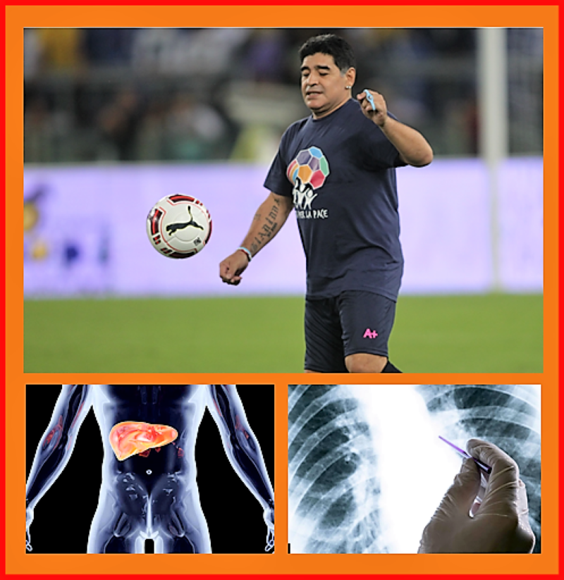  Maradona: las 6 enfermedades que más problemas le dieron al pibe de oro