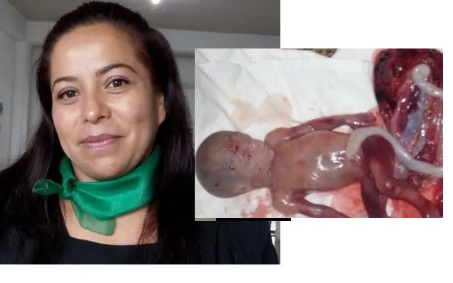 Pretenden matar niños prenatales a término en Hidalgo