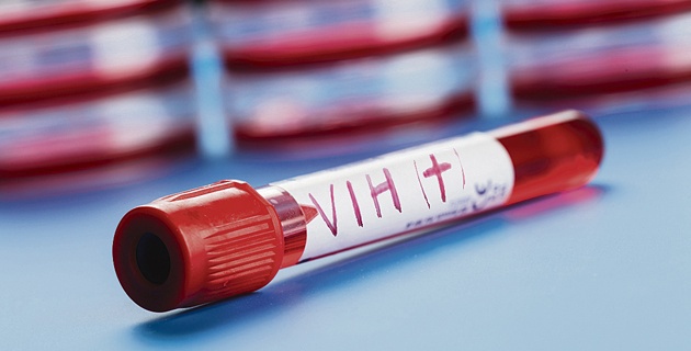 Universidad crea vacuna que ataca al 99% del virus del VIH