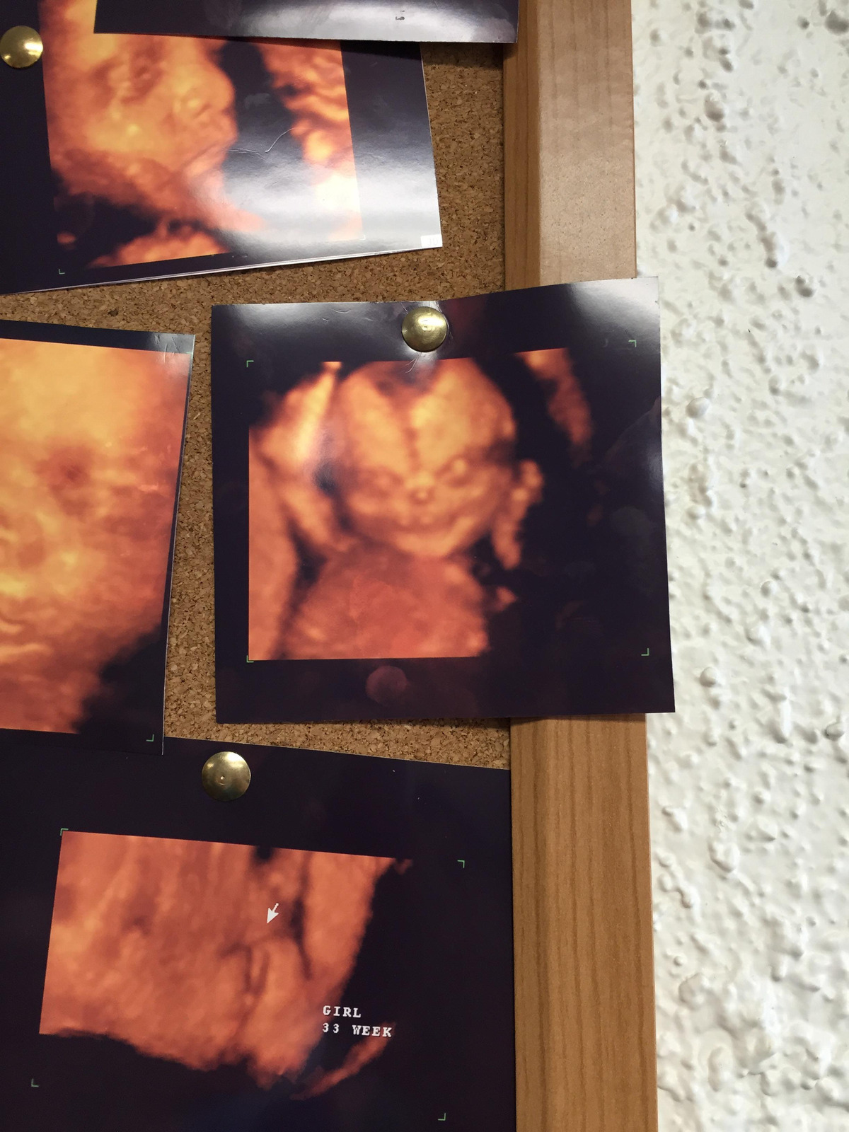 Couple finds out their unborn baby looks exactly like a demon