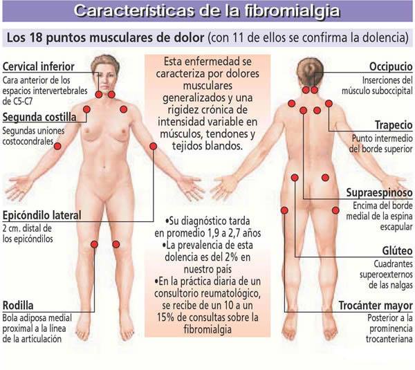 Características de la fibromialgia