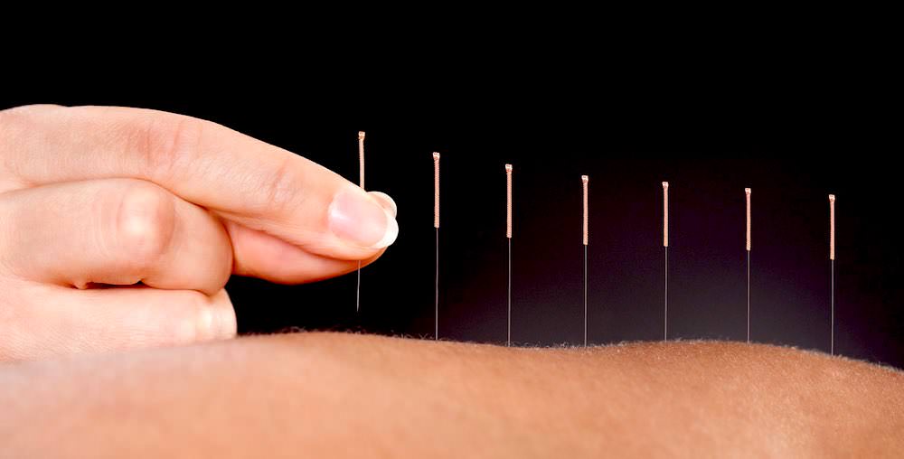  Is acupuncture effective for treating female infertility or incontinence?