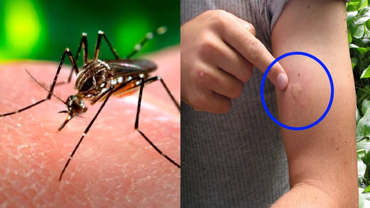 Here's the ingredient that causes mosquitos to leave you in peace for good