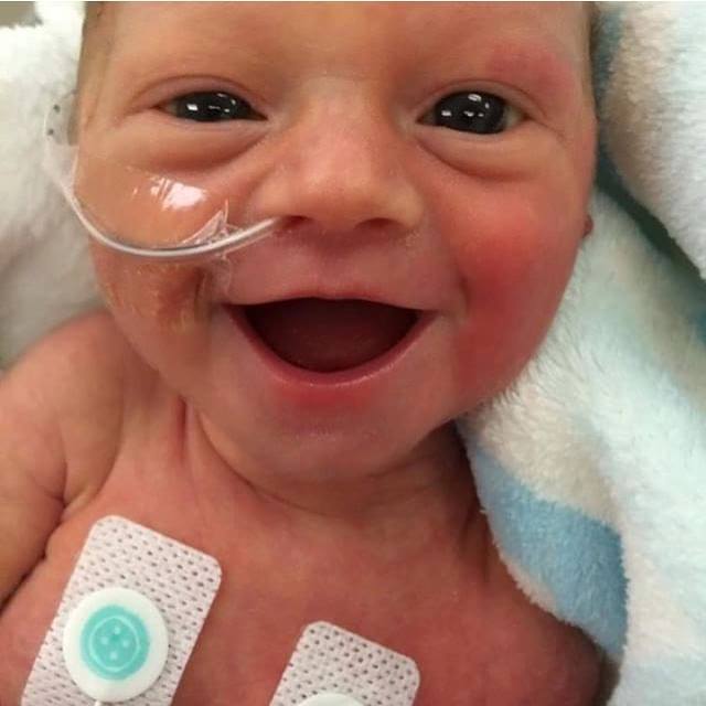 This 5 day-old premature baby's beautiful smile is giving hope to worried parents 