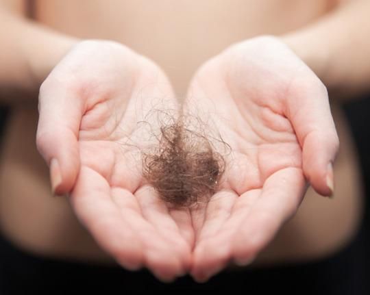 How Much Everyday Hair Loss Is Normal?