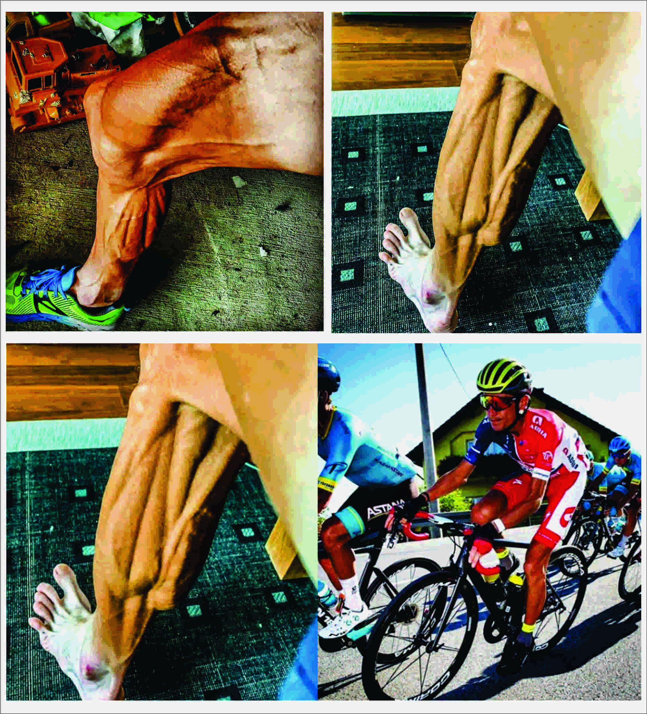 Las impresionantes imágenes de las piernas de un ciclista después de competir