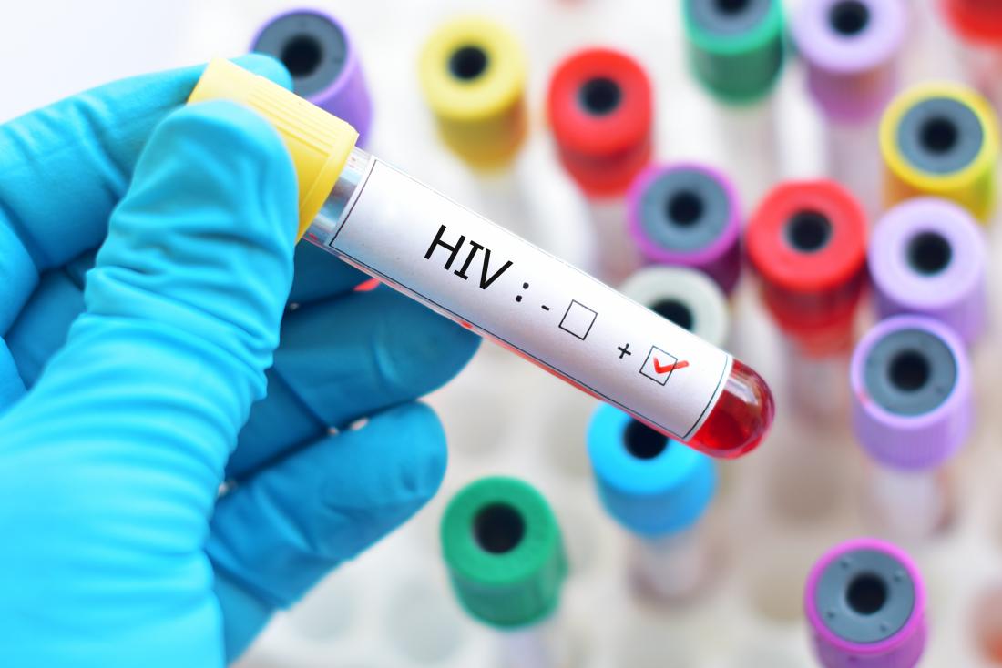 Researchers develop injectable implant to prevent, detect HIV