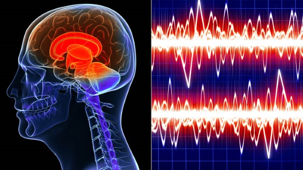 Novel Brain Cancer Treatment Taps Into Sound Waves