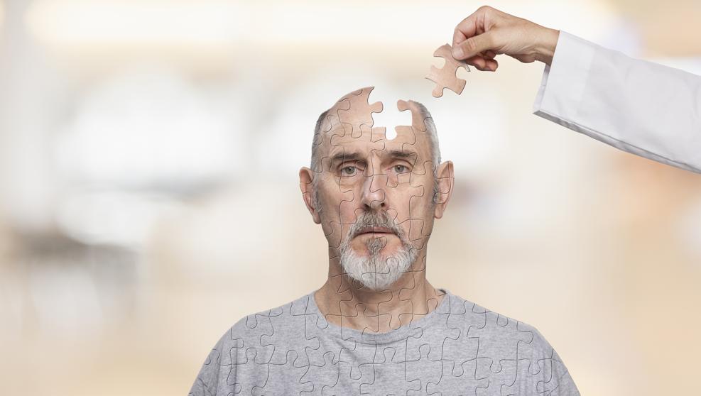 5 cosas que no sabías sobre el Alzheimer
