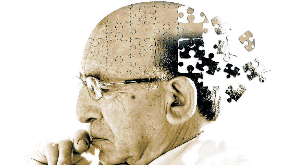 El Alzheimer podría ser una enfermedad transmisible según estudios