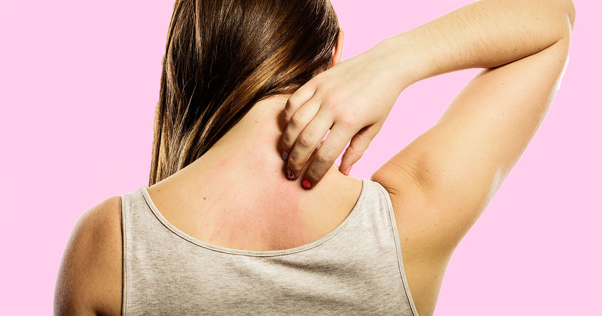 This is the reason why your skin itches when you work out