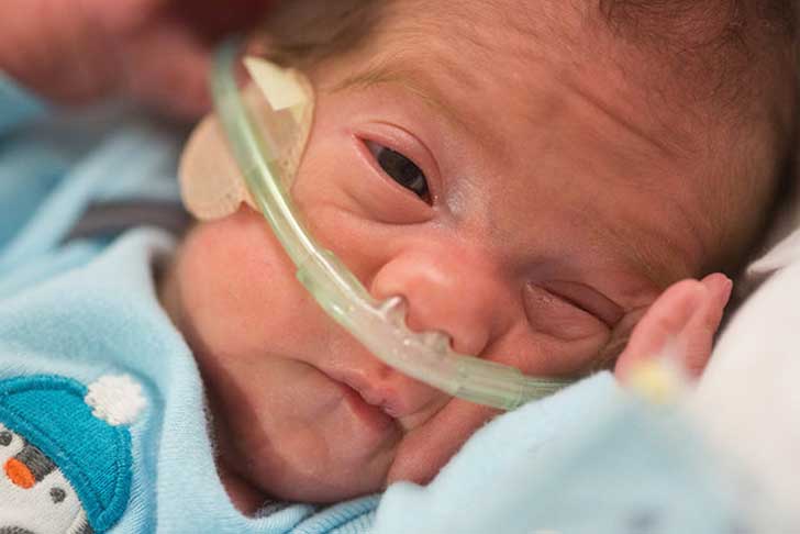 Dio a luz 54 días después de su muerte cerebral