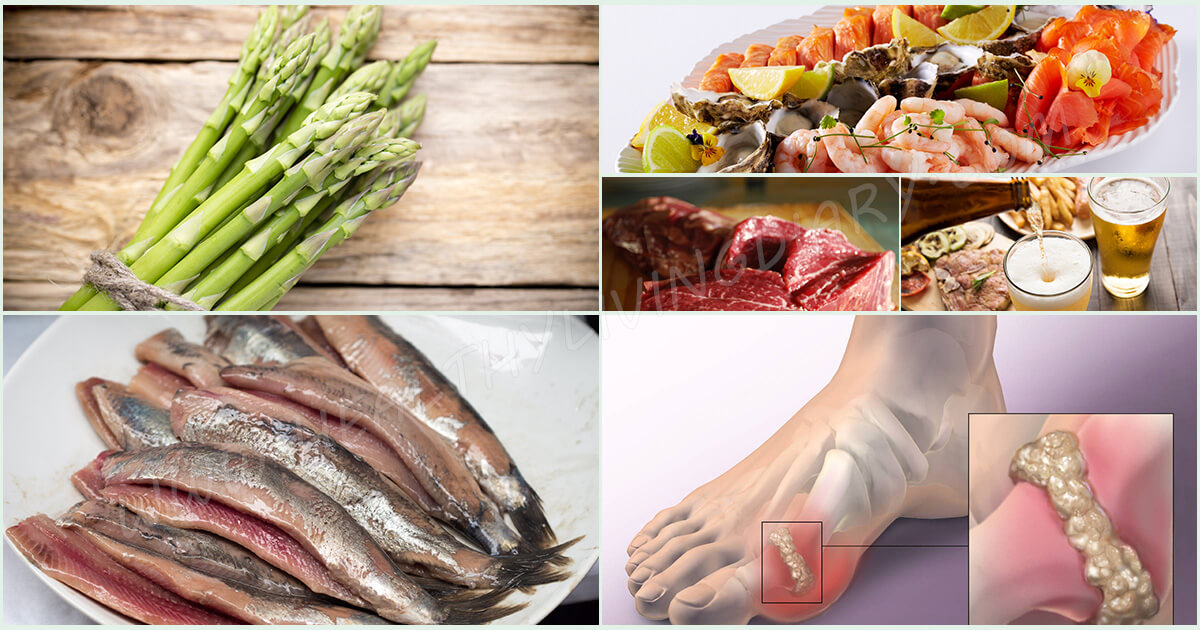 14 foods that cause gout