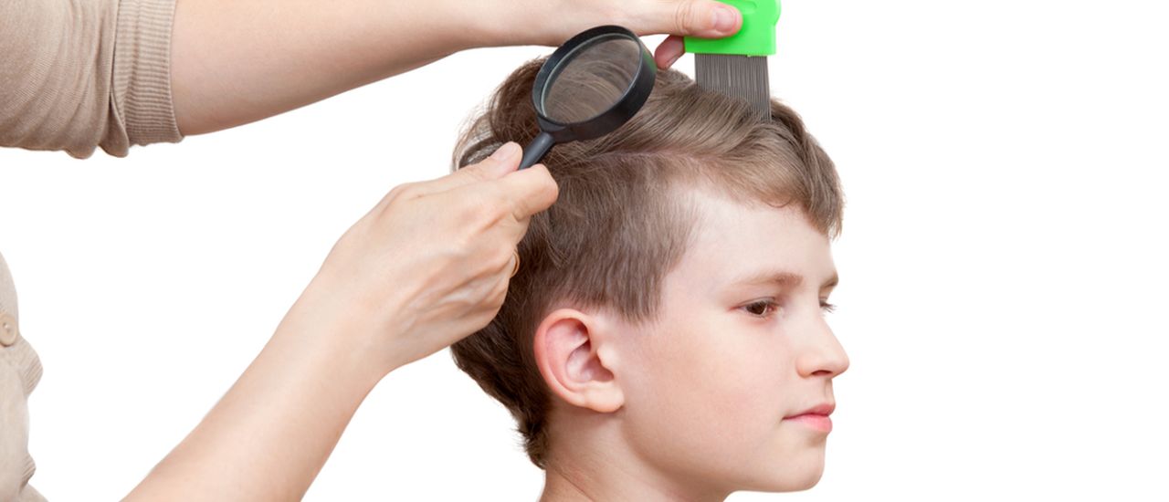 This is how you get rid of lice quick and cheap!