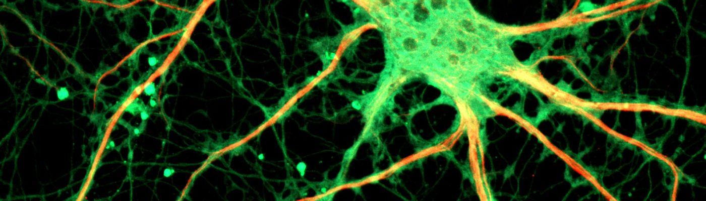 Scientists want to grow new neurons in old brains