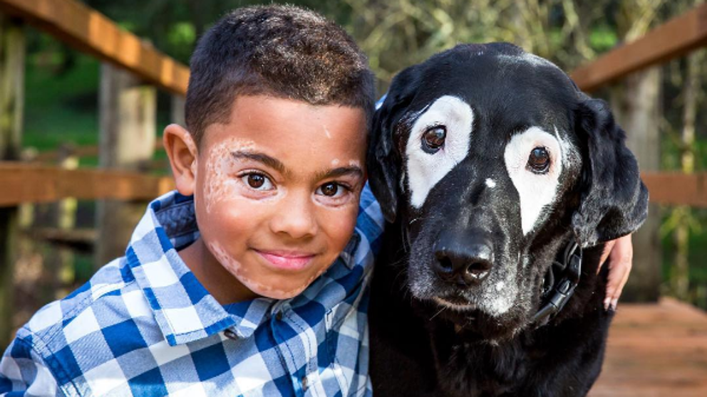 Un niño sale de la depresión al conocer a un perro con su misma enfermedad
