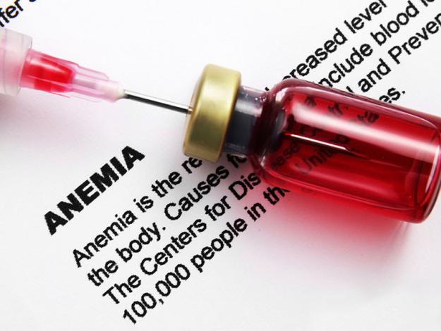 ¿Qué es la anemia y cuáles son sus causas?