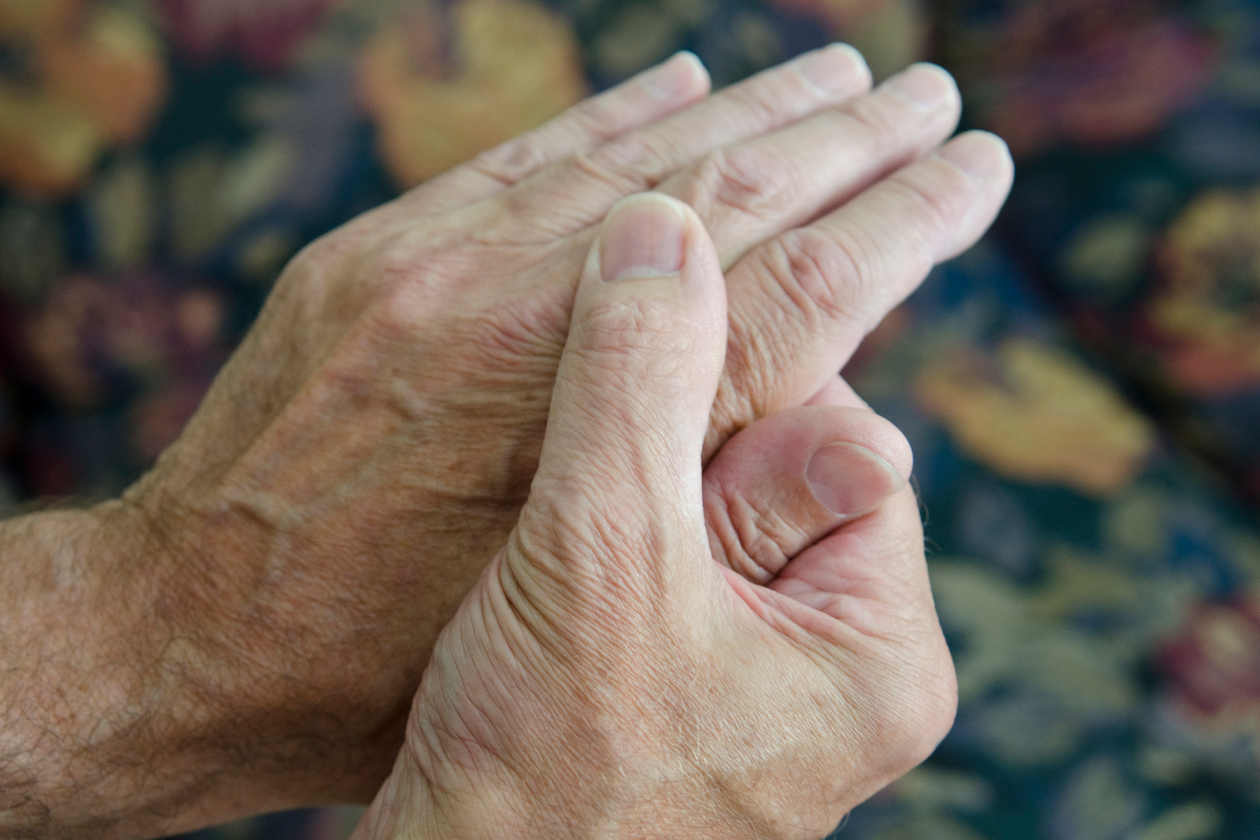 Calma los síntomas de la artritis en las manos con estos remedios naturales