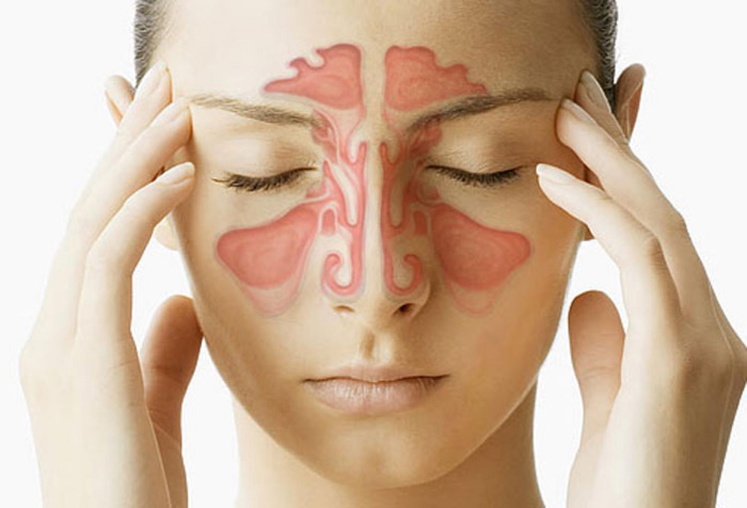 40 remedios para la sinusitis que debes probar