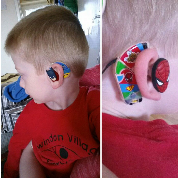 Supermom designs superhero hearing aids for kids
