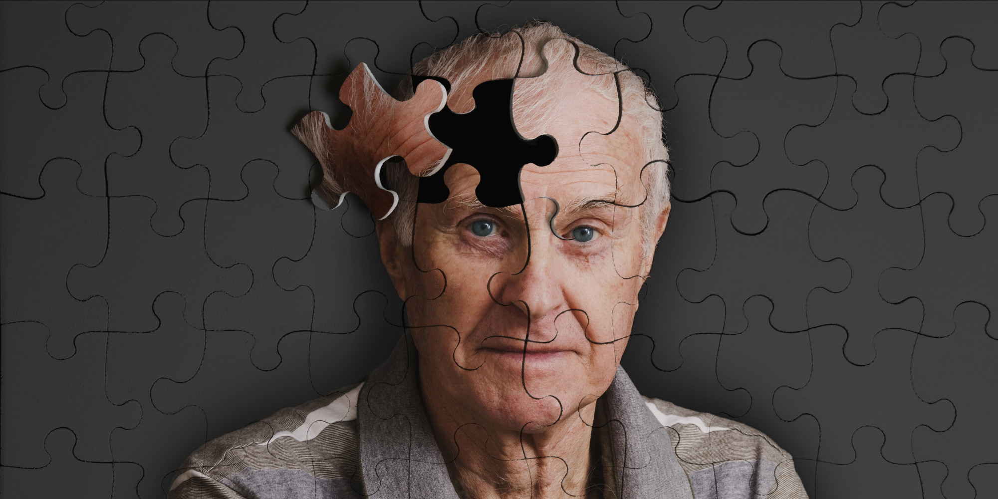 Medicamento experimental podría curar el alzheimer