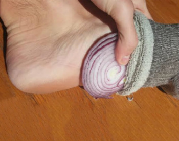 This is What Happens When You Put Cut Up Onions in Your Socks While You Sleep 