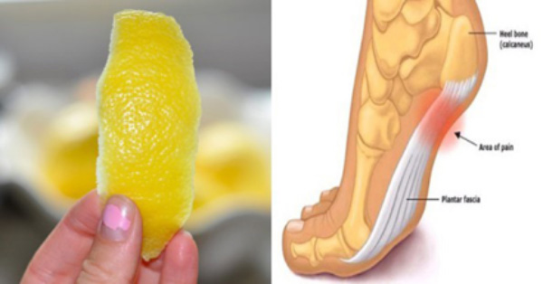 Este truco de la cáscara de limón puede combatir la inflación y el dolor