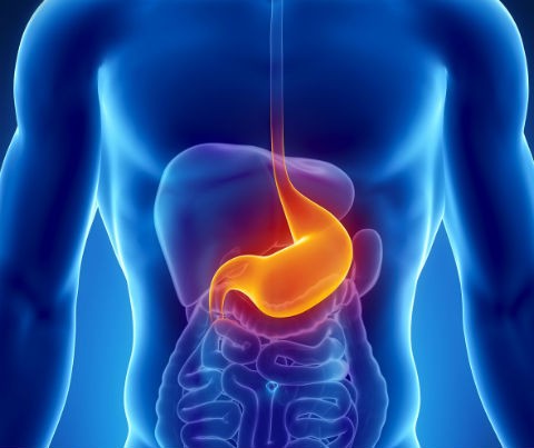 Gastritis. Causas, Sintomas y Remedios Caseros 